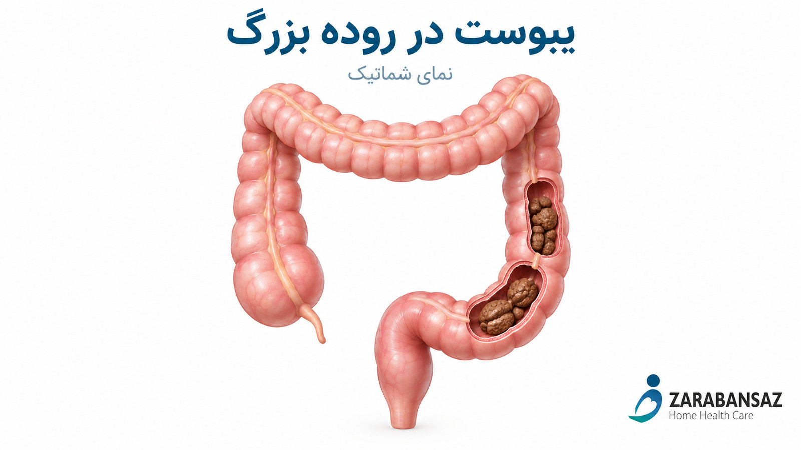 treating-sore-throat-at-home