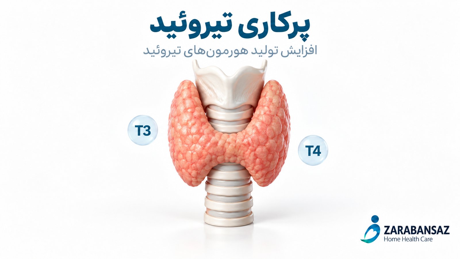 پرکاری تیروئید