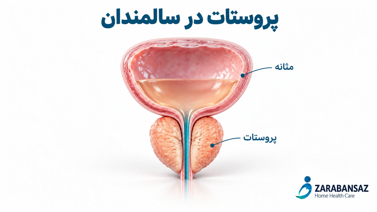 پروستات در سالمندان