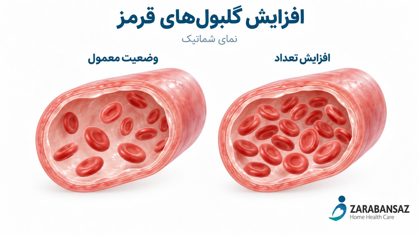 غلظت خون