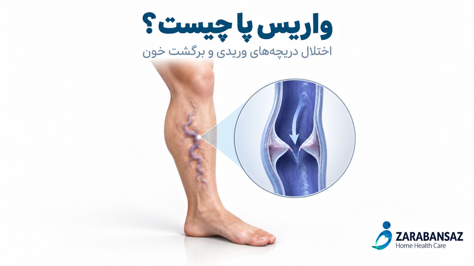 بالا گذاشتن پا روی تکیهگاه و نمایش جوراب فشاری برای مراقبت حمایتی از واریس